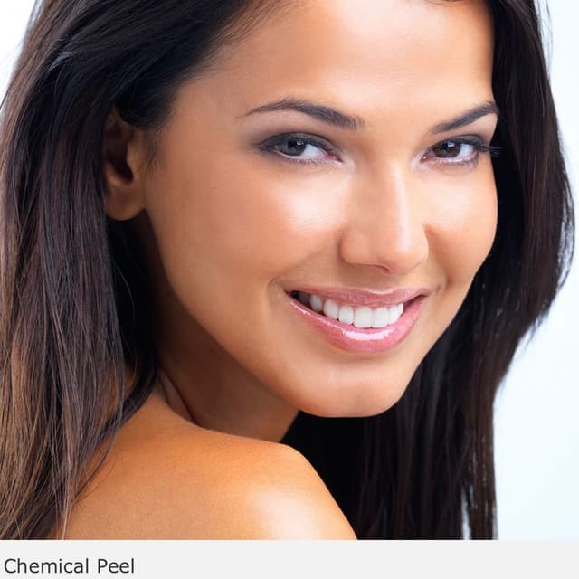 Chemical peel face  package of 3 at iBrow Threading Salon in Rome, GA